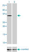 Eukaryotic Translation Initiation Factor 2 Subunit Alpha antibody, LS-C197117, Lifespan Biosciences, Western Blot image 