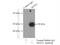 Sestrin-1 antibody, 55010-1-AP, Proteintech Group, Immunoprecipitation image 