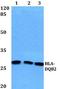 Major Histocompatibility Complex, Class II, DQ Beta 2 antibody, A07191, Boster Biological Technology, Western Blot image 