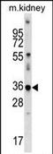 Cyclin Dependent Kinase Like 4 antibody, PA5-71936, Invitrogen Antibodies, Western Blot image 