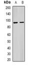 Interleukin 1 Receptor Accessory Protein antibody, abx141734, Abbexa, Western Blot image 
