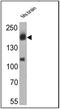 Erb-B2 Receptor Tyrosine Kinase 4 antibody, NB120-3104, Novus Biologicals, Western Blot image 