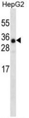 Ankyrin Repeat Domain 46 antibody, AP50196PU-N, Origene, Western Blot image 