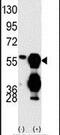 Protein Phosphatase, Mg2+/Mn2+ Dependent 1F antibody, PA5-15572, Invitrogen Antibodies, Western Blot image 