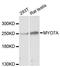 Myosin VIIA antibody, LS-C746802, Lifespan Biosciences, Western Blot image 