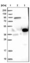 Estrogen Receptor Binding Site Associated Antigen 9 antibody, NBP1-84922, Novus Biologicals, Western Blot image 