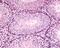 GLI2 antibody, 49-617, ProSci, Enzyme Linked Immunosorbent Assay image 