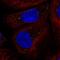 Coiled-Coil Domain Containing 93 antibody, HPA054183, Atlas Antibodies, Immunofluorescence image 