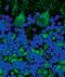 Cyclin Dependent Kinase 5 Regulatory Subunit 1 antibody, MA5-14834, Invitrogen Antibodies, Immunofluorescence image 