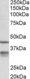 Hydroxysteroid 11-Beta Dehydrogenase 1 antibody, EB11062, Everest Biotech, Western Blot image 