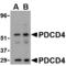 Programmed Cell Death 4 antibody, TA306366, Origene, Western Blot image 