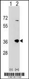 Sulfotransferase Family 1B Member 1 antibody, 58-619, ProSci, Western Blot image 