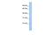 UDP Glycosyltransferase Family 3 Member A2 antibody, GTX46126, GeneTex, Western Blot image 