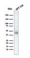 Keratin 8 antibody, GTX34670, GeneTex, Western Blot image 