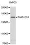 Timeless Circadian Regulator antibody, STJ25852, St John