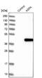 Aspartoacylase antibody, NBP1-89258, Novus Biologicals, Western Blot image 