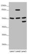 Serine/threonine-protein phosphatase 2A regulatory subunit B subunit gamma antibody, LS-C676303, Lifespan Biosciences, Western Blot image 