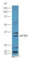 Eukaryotic Translation Initiation Factor 2B Subunit Alpha antibody, orb183337, Biorbyt, Western Blot image 