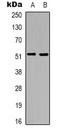 Tachykinin Receptor 3 antibody, orb339175, Biorbyt, Western Blot image 