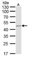 Fumarate Hydratase antibody, GTX630145, GeneTex, Western Blot image 