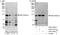 Adducin 2 antibody, A303-740A, Bethyl Labs, Western Blot image 