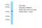 NSE4 Homolog A, SMC5-SMC6 Complex Component antibody, A14289, Boster Biological Technology, Western Blot image 