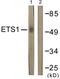 ETS Proto-Oncogene 1, Transcription Factor antibody, LS-C117643, Lifespan Biosciences, Western Blot image 