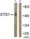 ETS Proto-Oncogene 1, Transcription Factor antibody, LS-C117643, Lifespan Biosciences, Western Blot image 