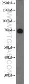 Negative Regulator Of Ubiquitin Like Proteins 1 antibody, 14343-1-AP, Proteintech Group, Western Blot image 