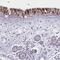 Von Willebrand Factor C Domain Containing 2 antibody, PA5-63097, Invitrogen Antibodies, Immunohistochemistry paraffin image 