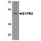 Sphingosine-1-Phosphate Receptor 2 antibody, TA349188, Origene, Western Blot image 