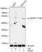 AP2M1 antibody, A06179T156, Boster Biological Technology, Western Blot image 