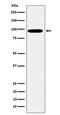 Epsin 1 antibody, M01870, Boster Biological Technology, Western Blot image 