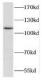 Glycine dehydrogenase [decarboxylating], mitochondrial antibody, FNab03476, FineTest, Western Blot image 