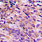 PEAK1 Related, Kinase-Activating Pseudokinase 1 antibody, LS-C353873, Lifespan Biosciences, Immunohistochemistry frozen image 