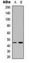 Mitogen-Activated Protein Kinase Kinase 1 antibody, orb256667, Biorbyt, Western Blot image 