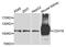 Cadherin 16 antibody, A7882, ABclonal Technology, Western Blot image 