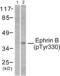 Ephrin B1 antibody, LS-C198902, Lifespan Biosciences, Western Blot image 