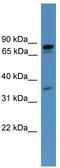 High affinity cAMP-specific and IBMX-insensitive 3 ,5 -cyclic phosphodiesterase 8A antibody, TA344622, Origene, Western Blot image 