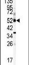 Cytochrome P450 Family 1 Subfamily A Member 1 antibody, PA5-15213, Invitrogen Antibodies, Western Blot image 