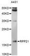 Ribonuclease P/MRP Subunit P21 antibody, LS-C749426, Lifespan Biosciences, Western Blot image 