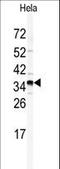 Golgi Phosphoprotein 3 antibody, LS-C100647, Lifespan Biosciences, Western Blot image 
