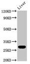 RAB26, Member RAS Oncogene Family antibody, LS-C675052, Lifespan Biosciences, Western Blot image 