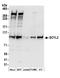 SCY1 Like Pseudokinase 2 antibody, A304-879A, Bethyl Labs, Western Blot image 