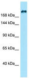 Kinesin Family Member 21B antibody, TA331265, Origene, Western Blot image 