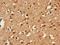 Ubiquitin Specific Peptidase 18 antibody, CSB-PA891559LA01HU, Cusabio, Immunohistochemistry paraffin image 