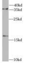Fragile Histidine Triad Diadenosine Triphosphatase antibody, FNab09817, FineTest, Western Blot image 
