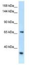 RNA Binding Motif Protein 15B antibody, NBP1-82412, Novus Biologicals, Western Blot image 