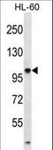 Tubulin Tyrosine Ligase Like 4 antibody, LS-C160317, Lifespan Biosciences, Western Blot image 