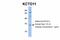 Potassium Channel Tetramerization Domain Containing 11 antibody, 28-565, ProSci, Western Blot image 